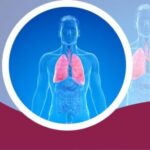 Logo del gruppo di BPCO: riduzione del danno e terapie, rischio globale e trattamenti complessi